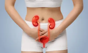 Femme tenant ses mains sur son bas-ventre, avec une illustration des reins et de la vessie enflammés. Cela illustre comment on attrape une infection urinaire chez la femme.