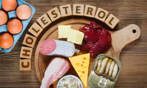 Œufs, beurre, foie, saucisson, lard, fromage, sardines en conserve et dés en bois formant le mot "cholestérol". Ces aliments sont riches en graisse saturée.