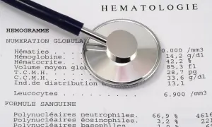 Un stéthoscope repose sur un compte rendu d'hématologie. Les résultats peuvent aider à évaluer la ferritine et l'inflammation.