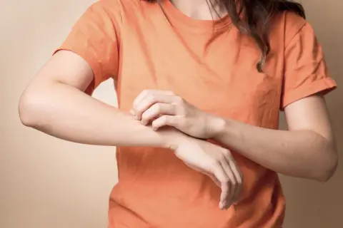 Une personne se gratte le bras, peut-être à cause d'une carence. Les vitamine b1 bienfaits incluent une peau saine.
