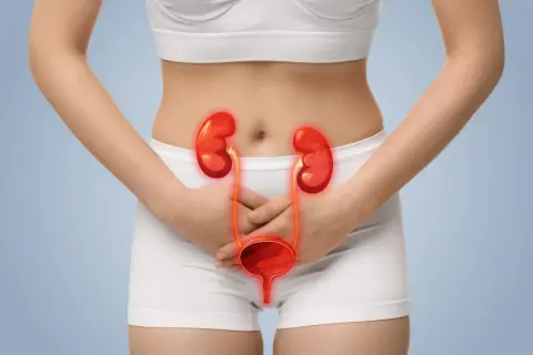 Femme tenant ses mains sur son bas-ventre, avec une illustration des reins et de la vessie enflammés. Cela illustre comment on attrape une infection urinaire chez la femme.