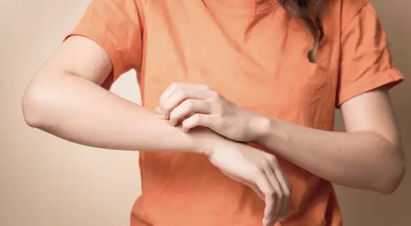 Une personne se gratte le bras, peut-être à cause d'une carence. Les vitamine b1 bienfaits incluent une peau saine.