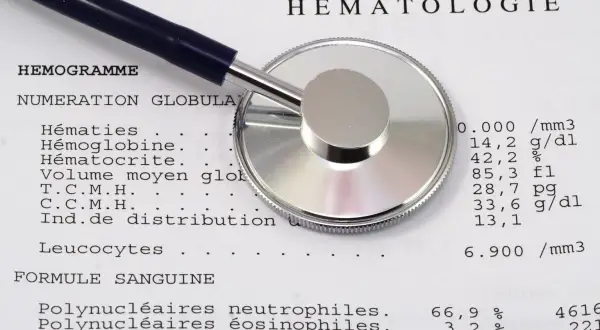 Un stéthoscope repose sur un compte rendu d'hématologie. Les résultats peuvent aider à évaluer la ferritine et l'inflammation.