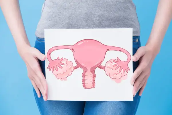 Une femme tient une illustration d'organes reproducteurs féminins, symbolisant peut-être une mycose ou des douleurs aux ovaires.